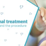 Root canal treatment – symptoms and the procedure